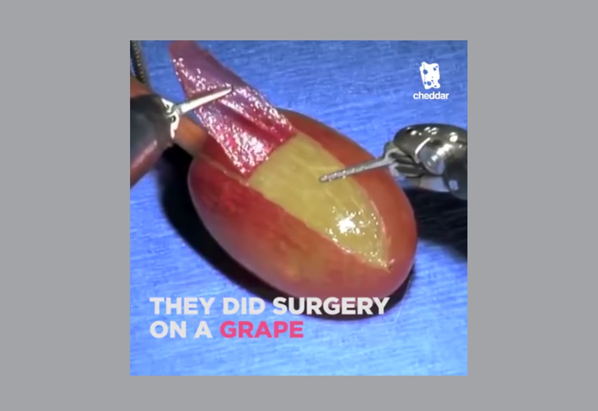 godnick_grape-surgery